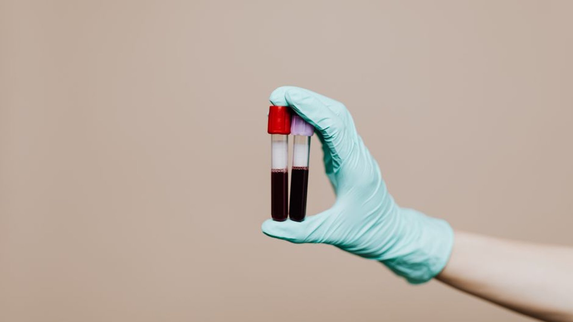 Miniature Schnauzer dog veterinary exam blood test